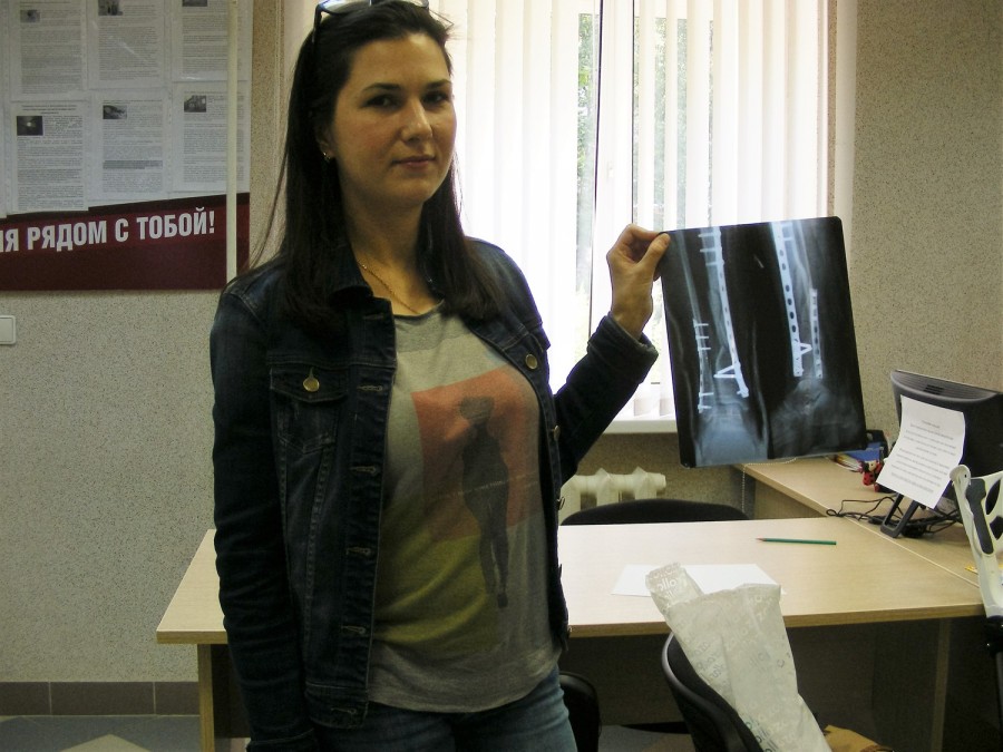 Жительница Петрозаводска отсудила у коммунальщиков 125 тысяч за сломанную ногу